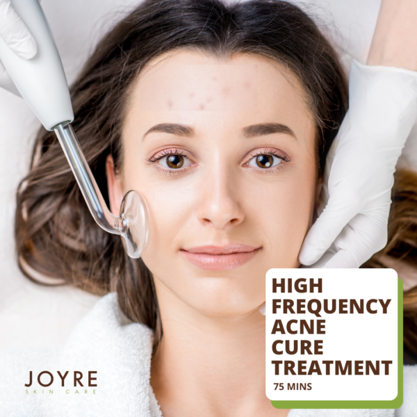 High Frequency Acne Cure Treatment